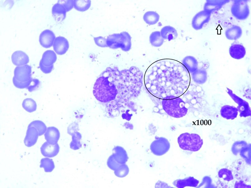 Diagnosis and Testing for Histoplasmosis, Types of Diseases, Histoplasmosis, Fungal Disease