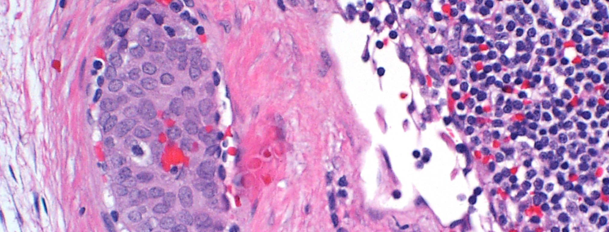 Protocols and Guidelines | College of American Pathologists