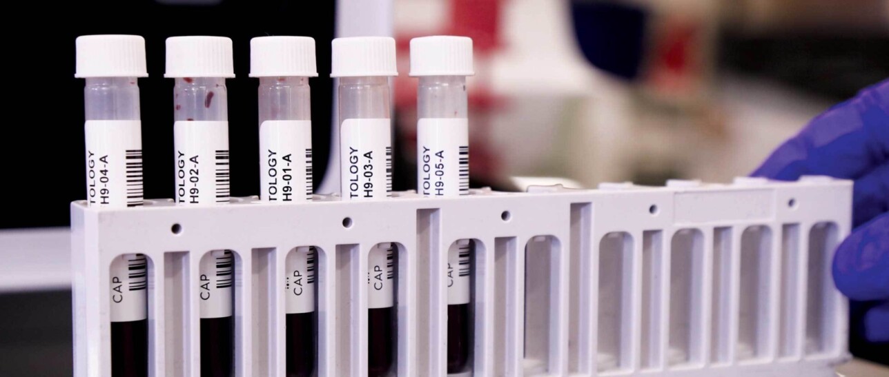 Proficiency Testing Resources College of American Pathologists