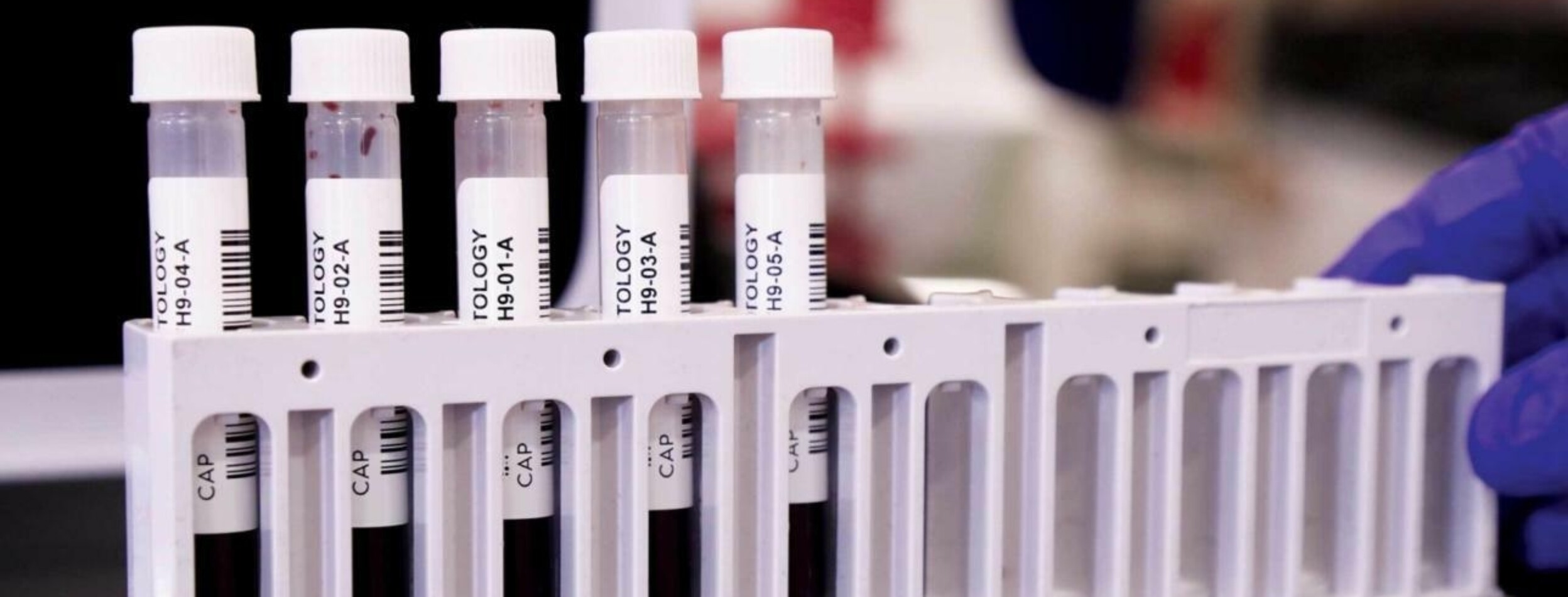 Laboratory Improvement College of American Pathologists